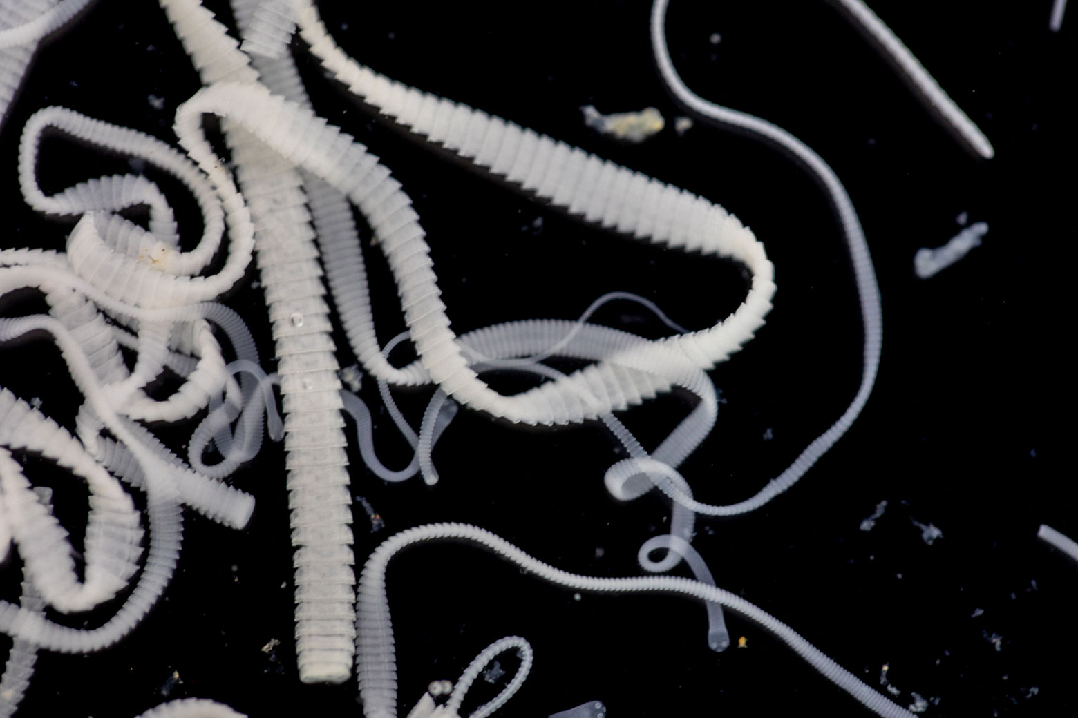 A cluster of tapeworms.